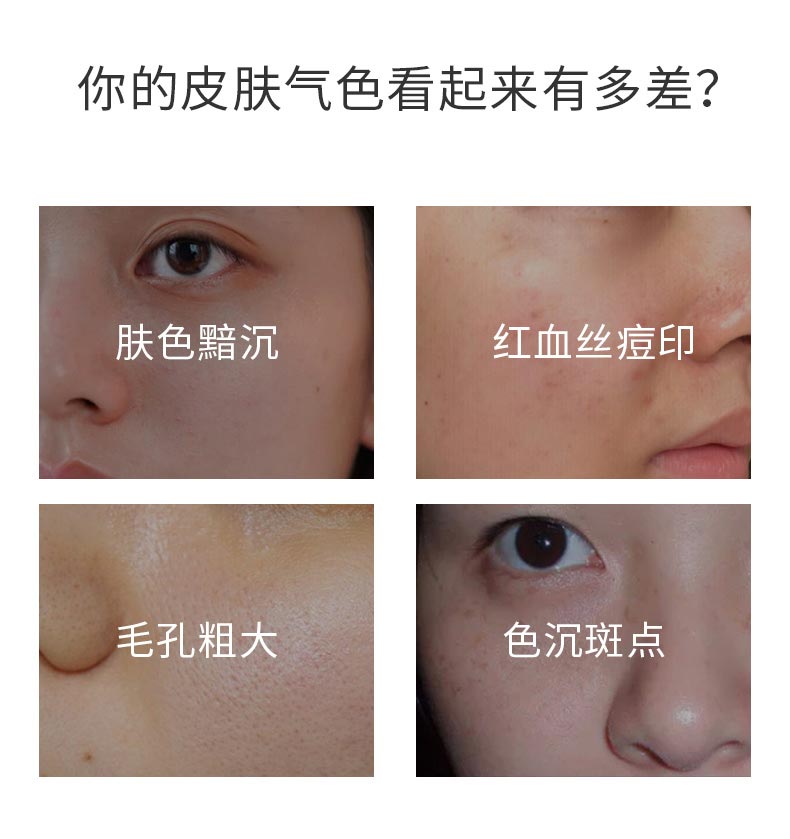 你的皮肤气色看起来有多差？