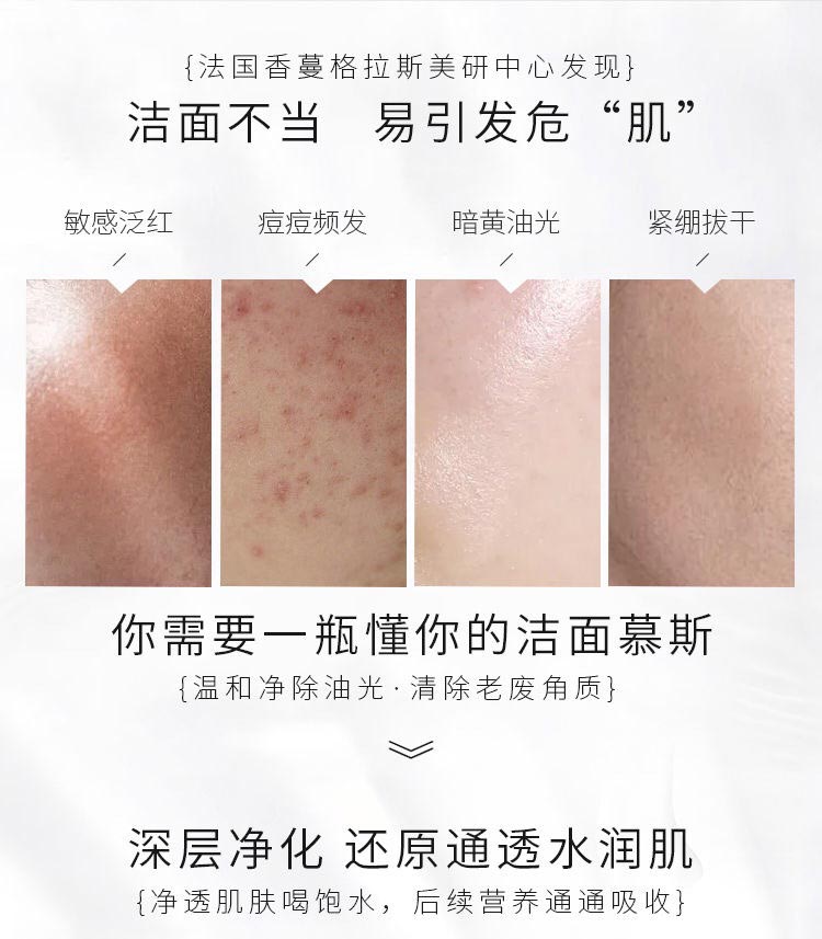 洁面不当 易引发危肌