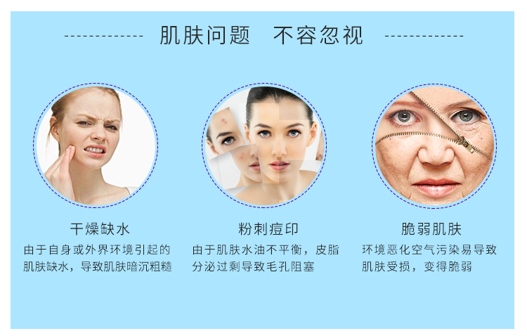 妮致(NEERJA)肌密保湿精华30ml肌肤问题