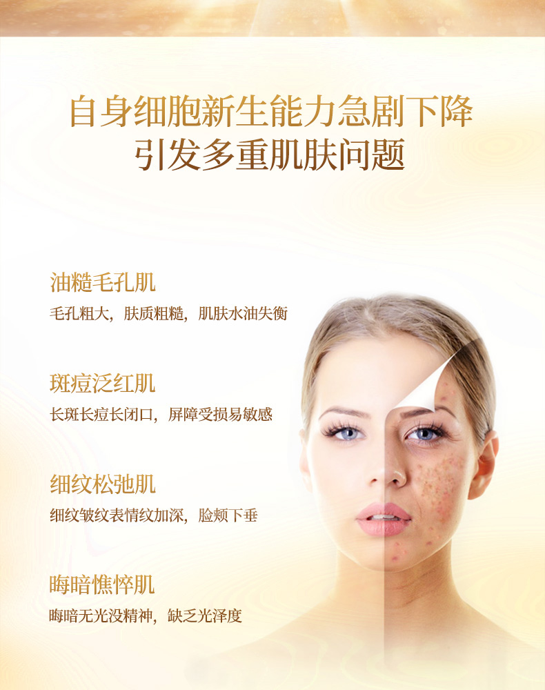 赛斯兰黛(SELAUDI)逆时空密集驻颜精华液30ml肌肤问题