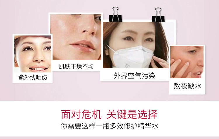 肌肤干燥产均 紫外线晒伤