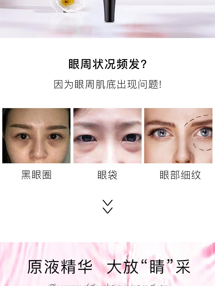 眼周肌底问题 /></p>
<p style=