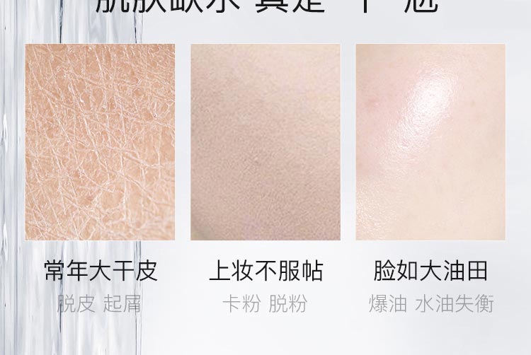 任意肌肤可用 尤适用干燥缺水肌