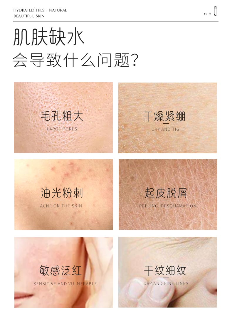 肌肤缺水 会导致什么问题