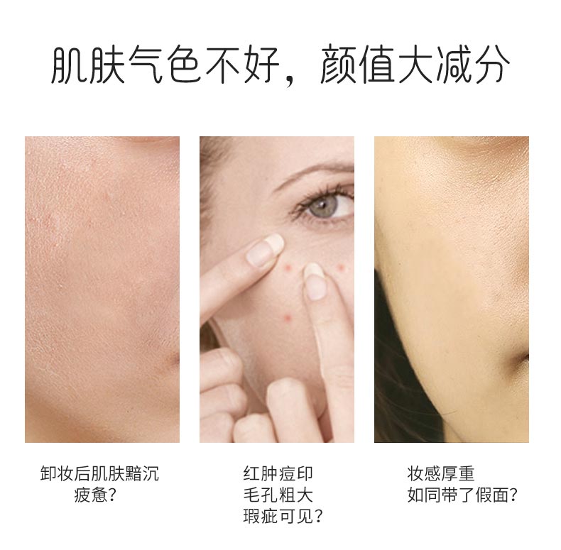 肌肤气色不好 颜值大减分