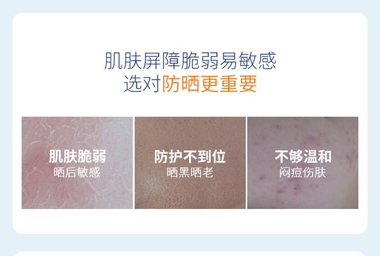 肌肤屏障脆弱易敏感