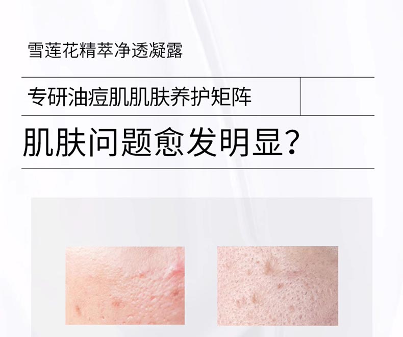 淮树雪莲花精萃净透凝露肌肤问题